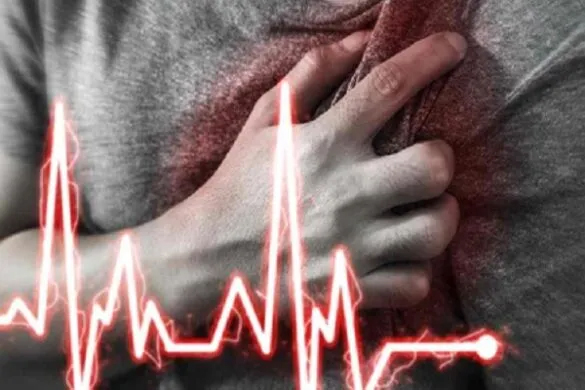 heart attack