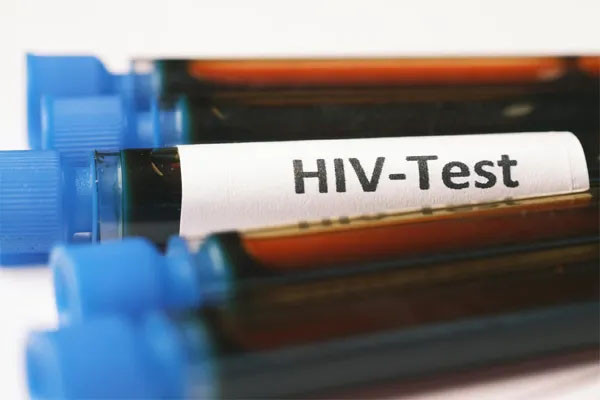 hiv test